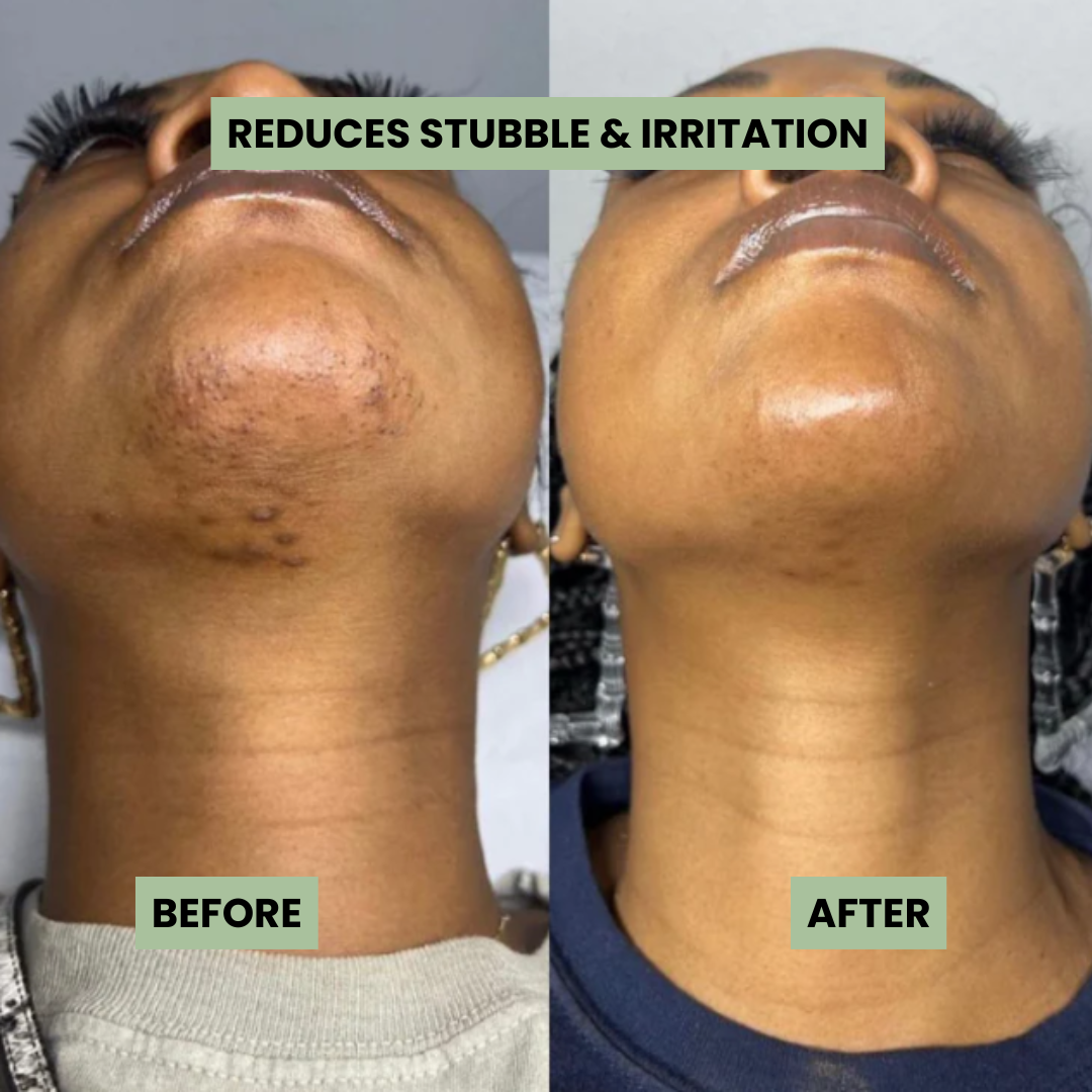 Hair Inhibiting Oil