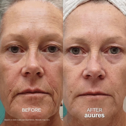 Facelift Massager 2.0